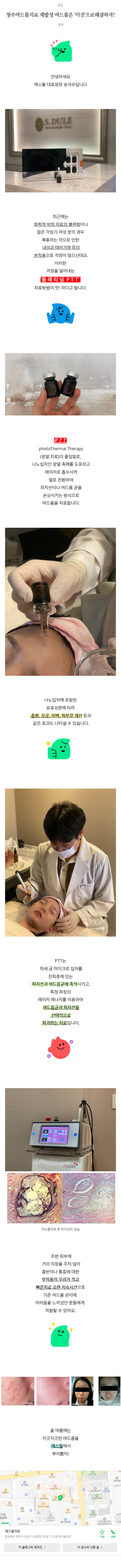 청주피부과유명한곳 tjgzl