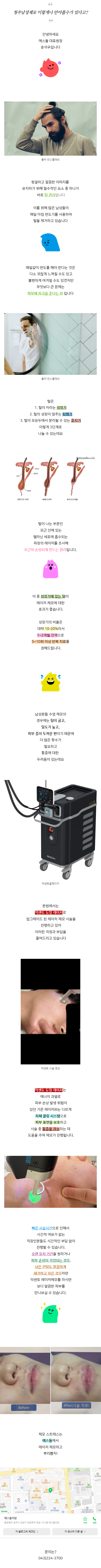 청주피부과유명한곳 hspcg